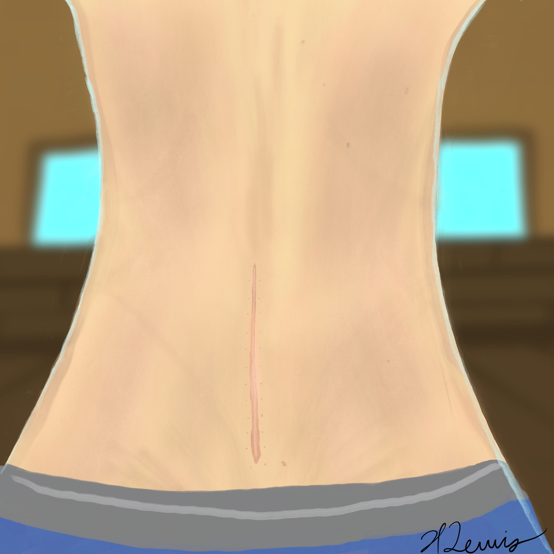 Portrait of a Spinal Fusion